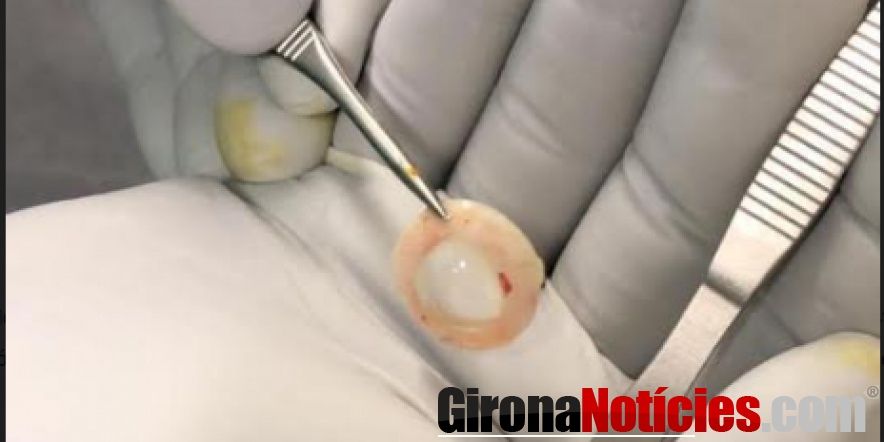 Extracció Còrnia
