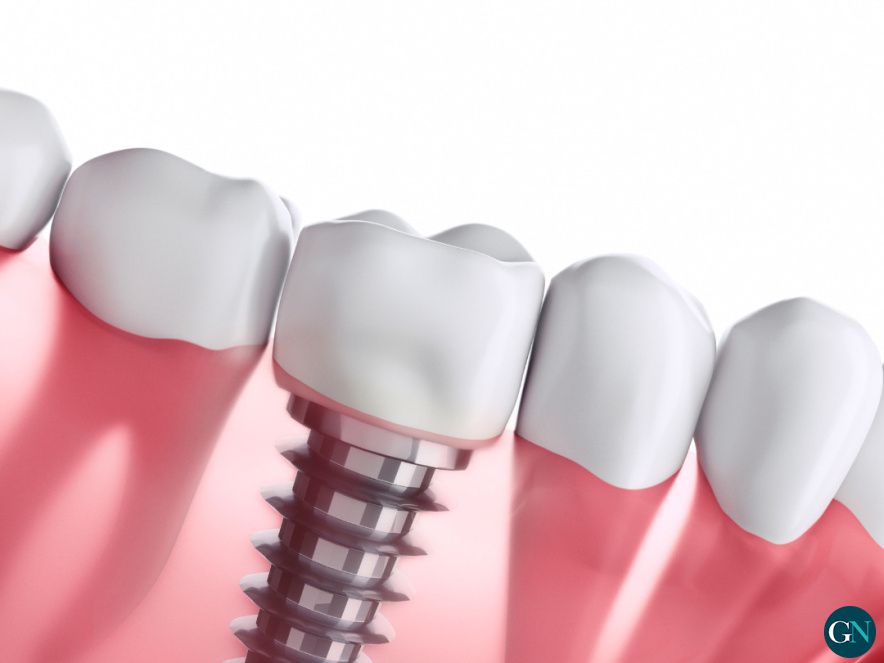 Custom Dental 